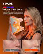 LED Red Light Face Mask, 460–850nm Near-Infrared Facial Light Mask with 3 Light Modes, White