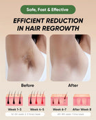 XSOUL At-Home IPL Hair Removal for Women and Men Permanent Hair Removal 999,999 Flashes Painless Hair Remover on Armpits Back Legs Arms Face Bikini Line, Corded