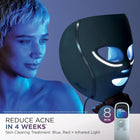 Shark CryoGlow LED Face Mask with Under-Eye Cooling, Anti-Ageing & Blemish Repair, Red & Blue LED, Infrared Light Therapy, USB-C, Remote Control, Storage Bag, FW312C (Canadian Version)