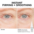 BeautyBio GLOfacial Hydro-Infusion Deep Pore Cleansing + Blue LED Clarifying Set: Tool + Concentrate