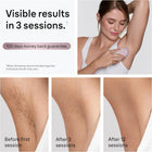 Braun Laser Hair Removal, IPL for Women & Men, Braun Silk-Expert Mini At-Home Laser with Venus Razor, PL1111